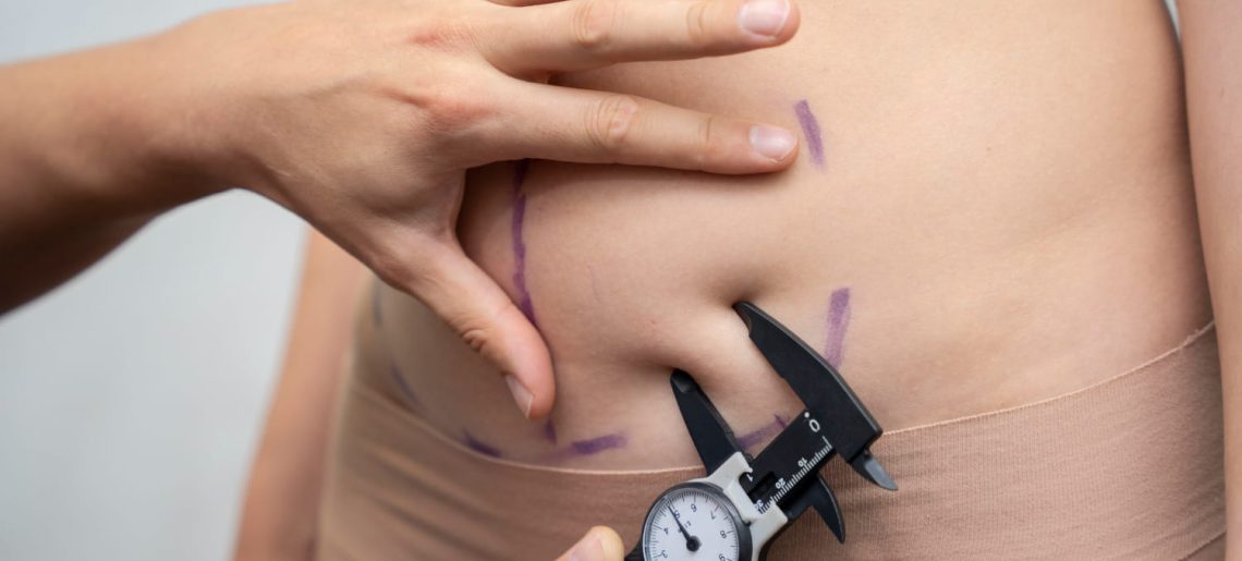 Your Go-to Guide to Choosing the Right Body Contouring Specialists
